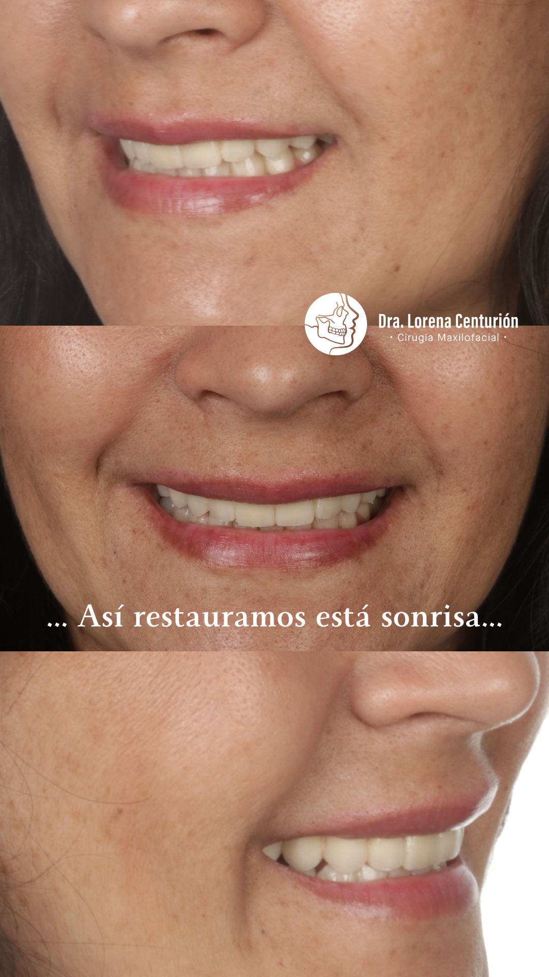 Historia Lorena Nuevo